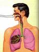 infecciones respiratorias Agudas